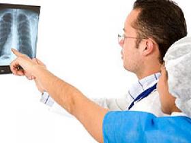 Suplementación con hierro aminora la hipertensión pulmonar