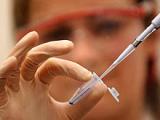 PCR detecta la infección bacteriana en la colecistitis