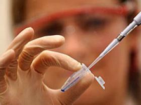 PCR detecta la infección bacteriana en la colecistitis