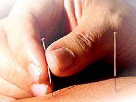 Adenosina regula los efectos analgésicos de la acupuntura