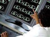 Altas dosis de vitamina D mejoran la inmunología de la esclerosis múltiple