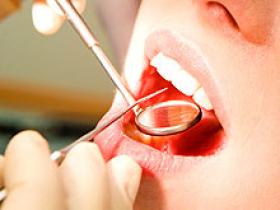 Enfermedad periodontal predispone a la hipertensión