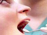 Los ácidos omega-3 protegen la salud periodontal