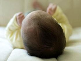 Propranolol es alternativa segura para los hemangiomas infantiles