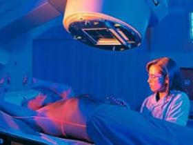 Radioterapia con partículas es segura y eficaz en el carcinoma hepatocelular