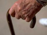 Pacientes con Parkinson tienen más riesgo de melanoma