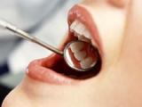 La calprotectina evidencia la periodontitis agresiva