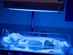 La fototerapia neonatal puede desarrollar lunares
