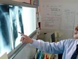 Radiografía anual de tórax no reduce mortalidad por cáncer de pulmón