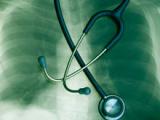 Grasa pericárdica daña la función pulmonar