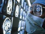 Acortamiento telomérico pronostica un accidente cerebrovascular