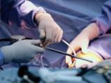 Edad del donante no influye en el trasplante renal