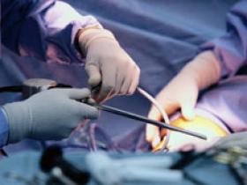 Edad del donante no influye en el trasplante renal