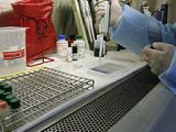 Células circulantes pronostican recurrencia y supervivencia del cáncer de mama