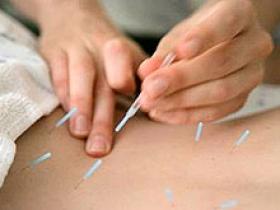 La acupuntura alivia el dolor crónico