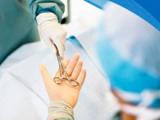 La hiponatremia predice morbilidad y mortalidad