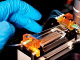 Variación RAD51B promueve el cáncer del seno masculino