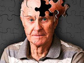 Extractos de ginkgo biloba no evitan progresión del  Alzheimer
