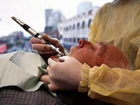Tratamiento intensivo de la periodontitis mejora la función endotelial