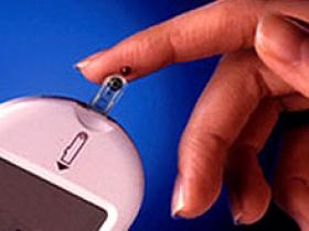 Transplante de células madre hematopoyéticas mejora la diabetes tipo 1