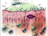 Enfermedad de Crohn, bacterias y sistema inmune