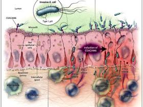 Enfermedad de Crohn, bacterias y sistema inmune