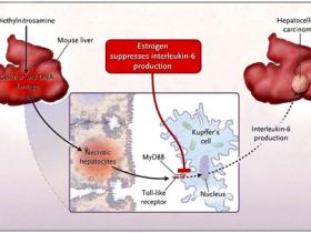 Carcinoma hepatocelular, un problema de género