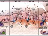 Colitis ulcerosa, ¿dónde estás T-bet?