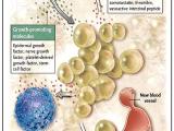Mastocitos: el alimento del cáncer de páncreas