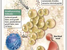 Mastocitos: el alimento del cáncer de páncreas