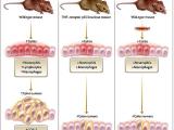 En la colitis y en el cáncer de colon