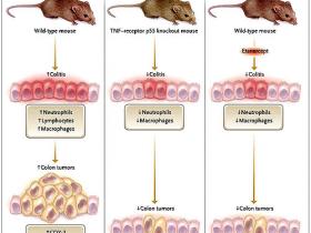 En la colitis y en el cáncer de colon