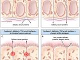 Integridad intestinal: una inquisición