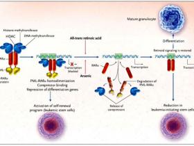 Leucemia promielocítica, el descontrol de una oncoproteína