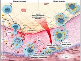 ¿Puedo revertir totalmente la aterosclerosis?