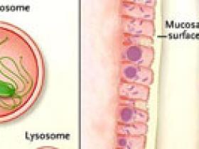 El camino a la enfermedad de Crohn