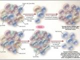 Para tratar la leucemia, el interferón alfa