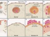 De la materia gris a la esclerosis múltiple