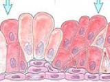 Células CARN: progenitoras del cáncer prostático