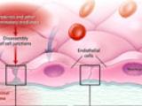 Los secretos de la sepsis