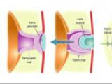 Ojos artificiales a partir de células madre