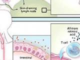 Diarrea infecciosa: simple pero difícil de tratar