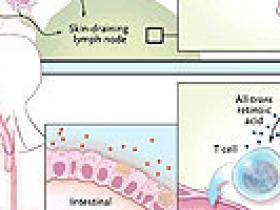 Diarrea infecciosa: simple pero difícil de tratar