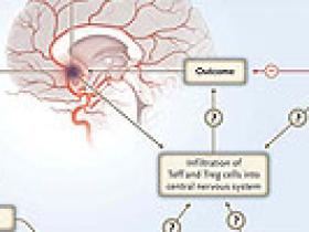 Infección, importante problema del accidente cerebrovascular