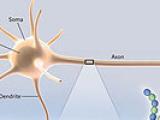 Neuropatía, por un diagnóstico más preciso