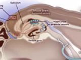 El camino del Alzheimer por el cerebro