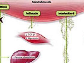 Cáncer de próstata y el músculo esquelético