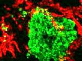 Esclerosis lateral amiotrófica: microglía y motoneuronas
