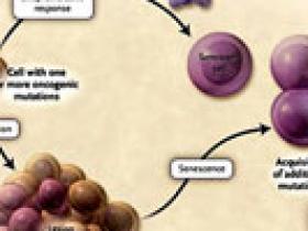 Alguna vez un crecimiento canceroso, ahora un lunar
