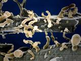 Nanobacterias: ¿hechos o fantasías?